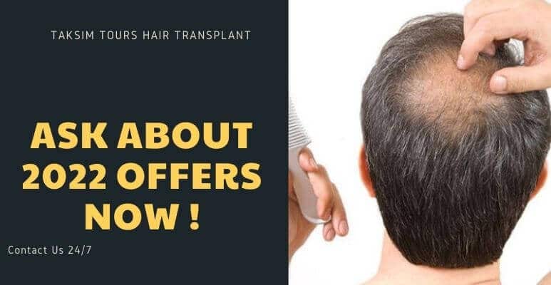 best hair transplant clinic in turkey 