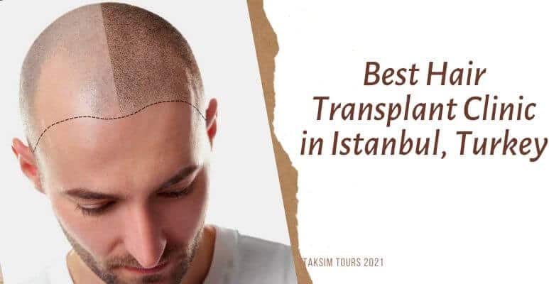 hair transplant in turkey or money back! ( low cost )