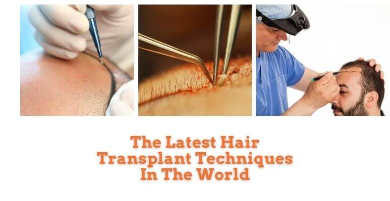 turkey hair transplant cost